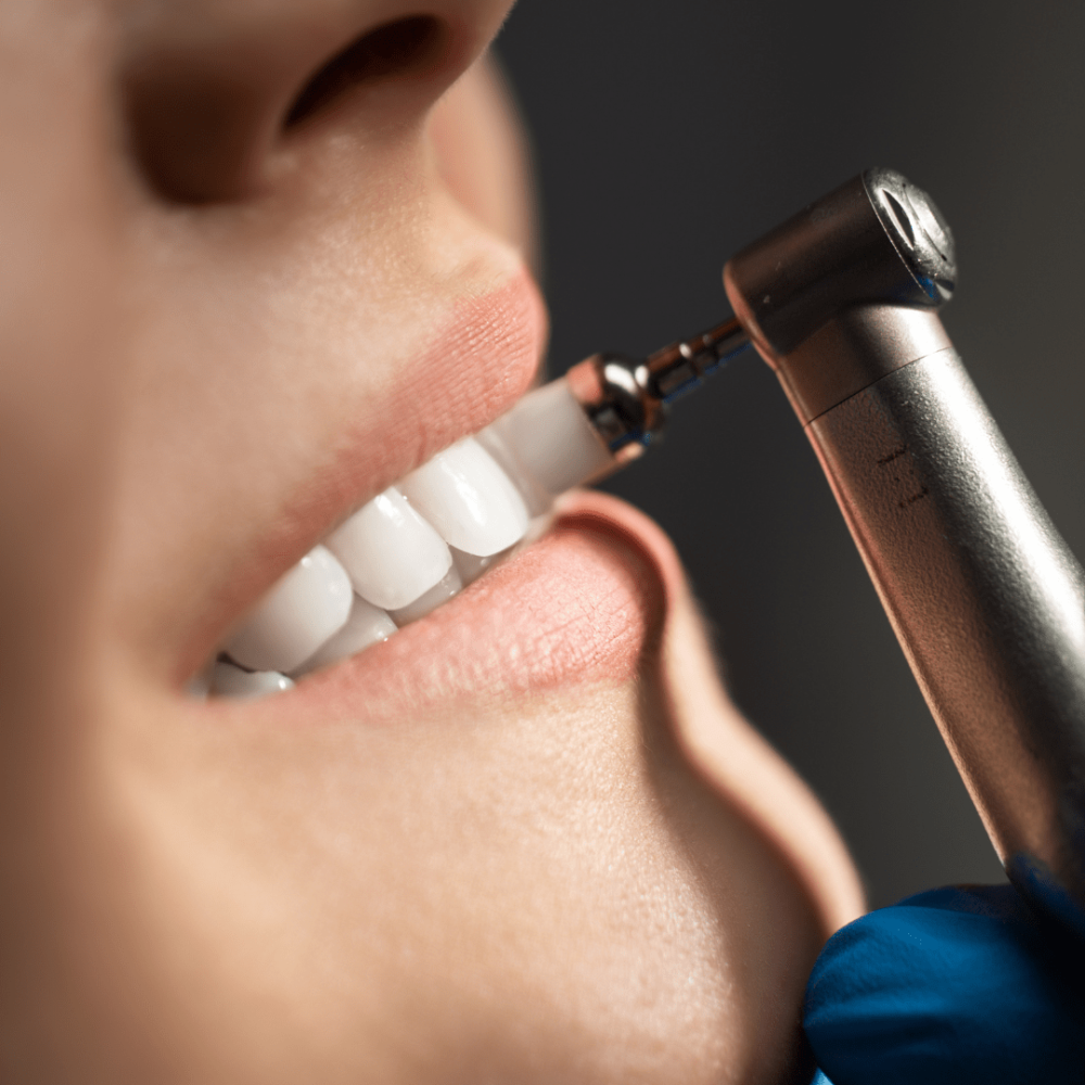 Dental-Scaling-min.png