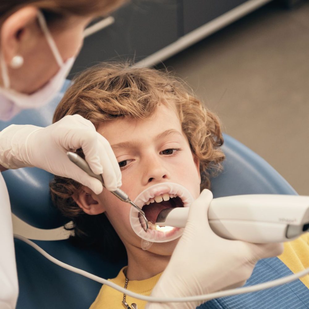 Intra Oral Scanner